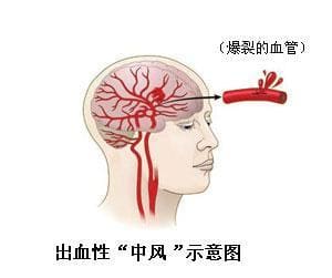 腦血管超聲多普勒.jpg